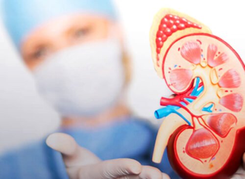 kidney dialysis